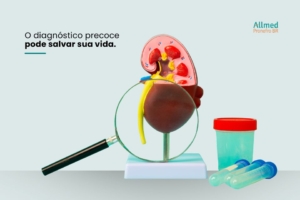 Creatinina o que é, valores normais e quando se preocupar