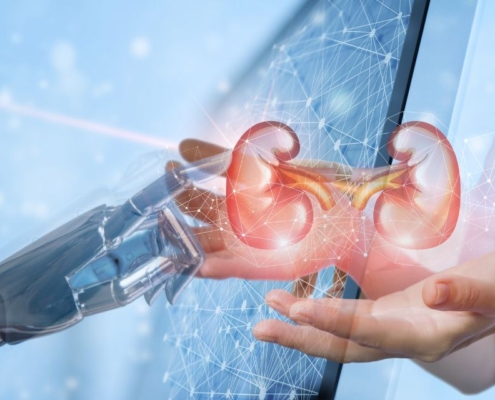 Inteligência artificial no tratamento renal vejas inovações que estão revolucionando a medicina