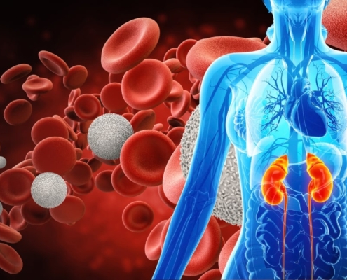 Endotoxemia e o paciente renal