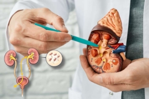 Infecção urinária de repetição um alerta para os rins