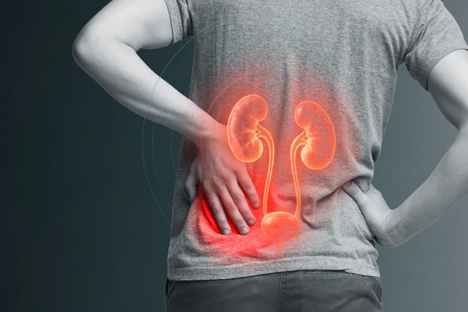 Calculo-renal-ou-nefrolitiase-sintomas-causas-prevencao